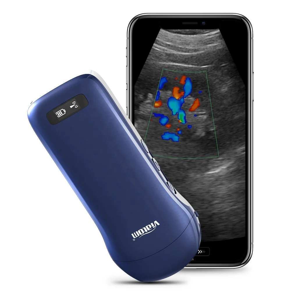 Viatom C10 128 элементов Wi-Fi ультразвуковой зонд Портативный беспроводной цветной допплер 3 в 1