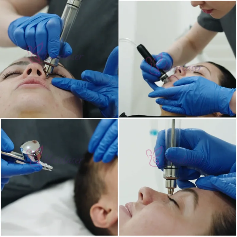 DermeLuxx аппарат для гидро-Дерма лица hudrafacial алмазный пилинг кристаллическая дермабразия Дермабразия