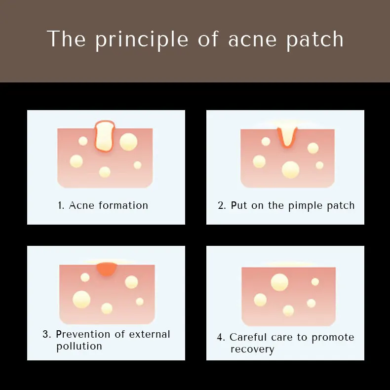 Hyaluronic Acid Microneedle Pimple Patch With Vitamin E Custom Fit Patches Made In Korea