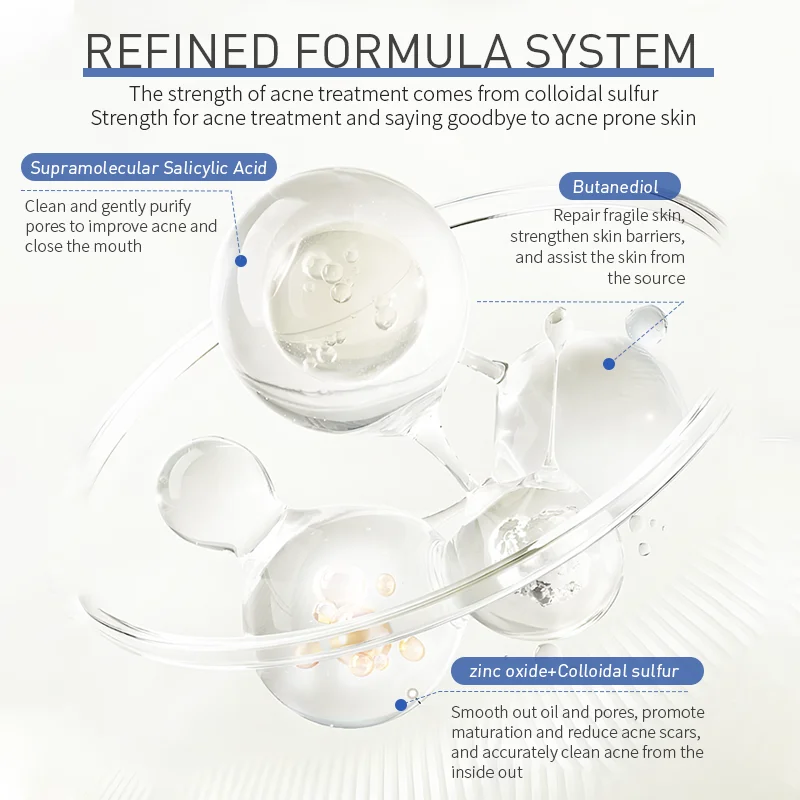 Acne Treatment Powder Water Serum Factory Direct Sales specially formulated for oily skin high speed effective acne treatment