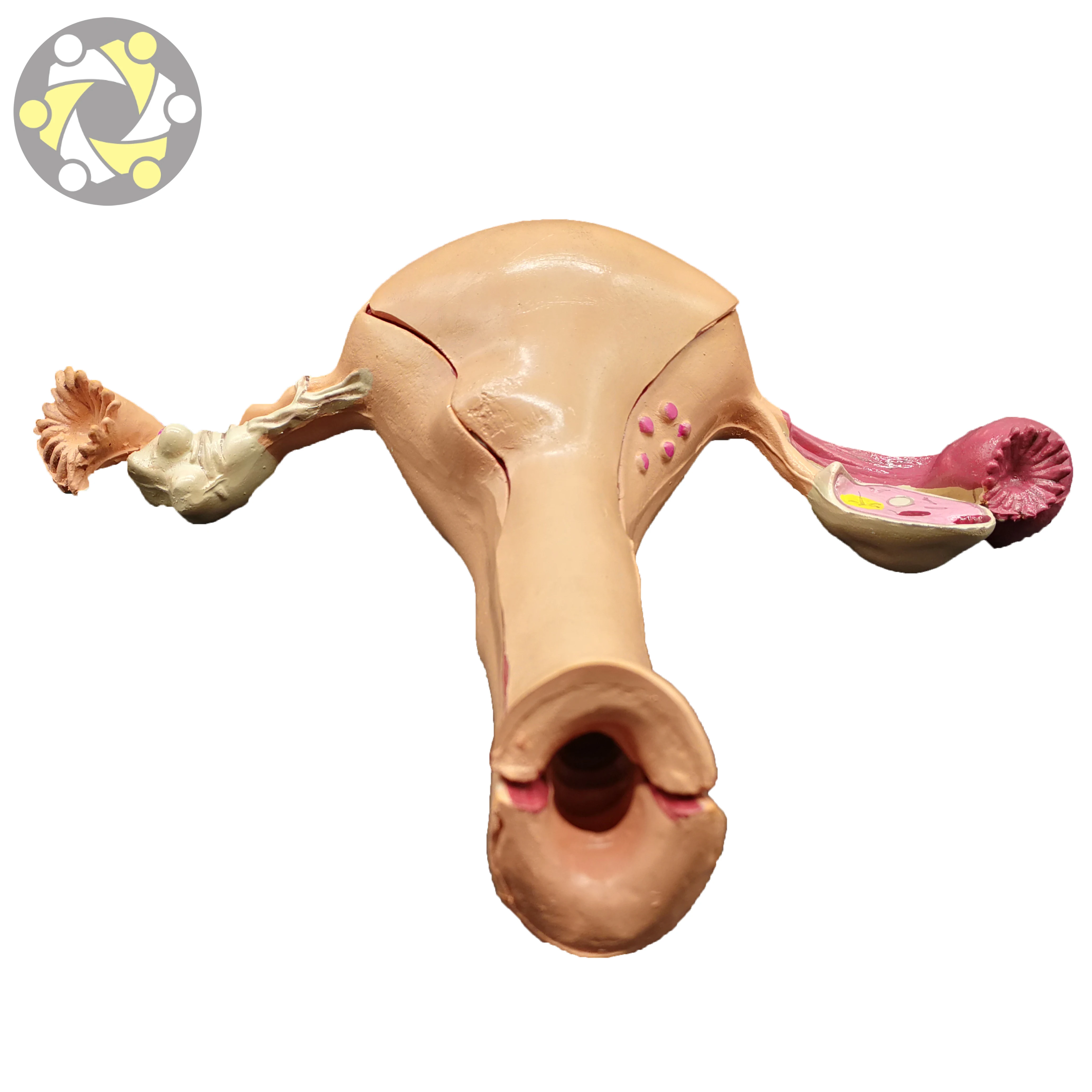 Female Uterine Fibroids Pathological Anatomical Model PVC Material for Medical Science and School Usage