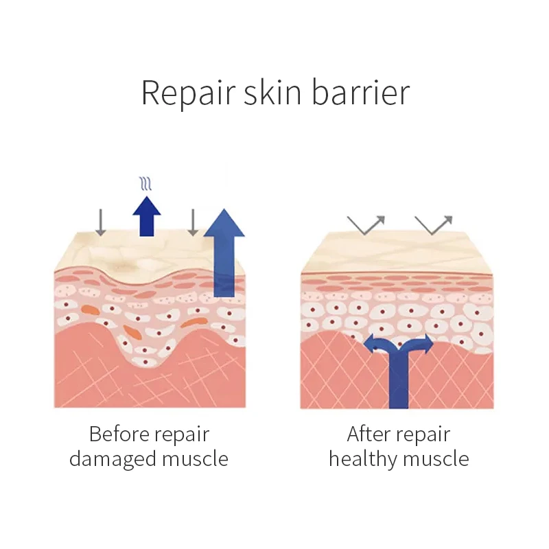 OEM/ODM Private label Skincare Set Organic VeganDamaged Skin Sensitive Skin Moisturizing Soothing Repairing Skin care set