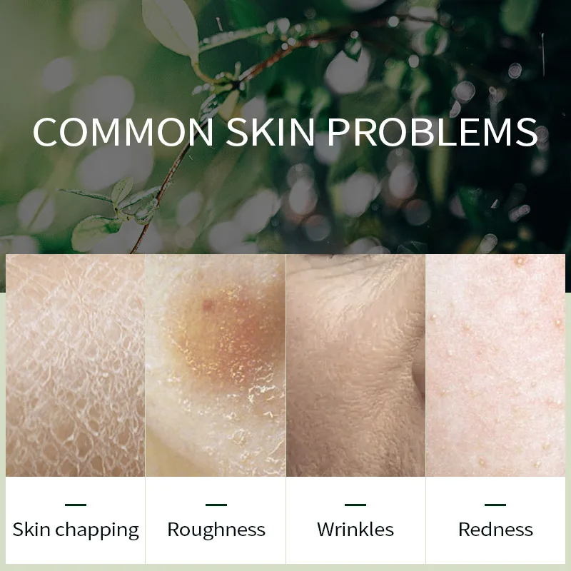 Natural Facial Care African Avocado Skin Care Cream Firming Lifting Moisturiser Anti Aging Cream Wrinkles Face Cream