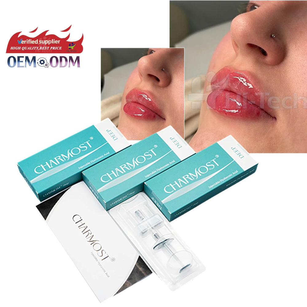 Korean Charmost  Ce Safety  Derm 2ml Hyaluronic Injector For Lips Wholesale Lip Filler Gel Hyaluronic Acid Hyaluronic Needless