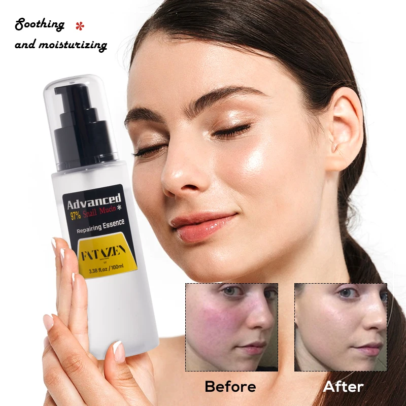Private Label Skin Care Products Anti Acne Snail Facial Serum OEM Anti-age Dark Spot Removal Repairing Moisturizing Face Serum