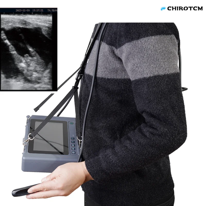 Low Cost High Performance Handheld Ultrasound Machine Veterinary Equipment Portable Ultrasound Scanner for Animals