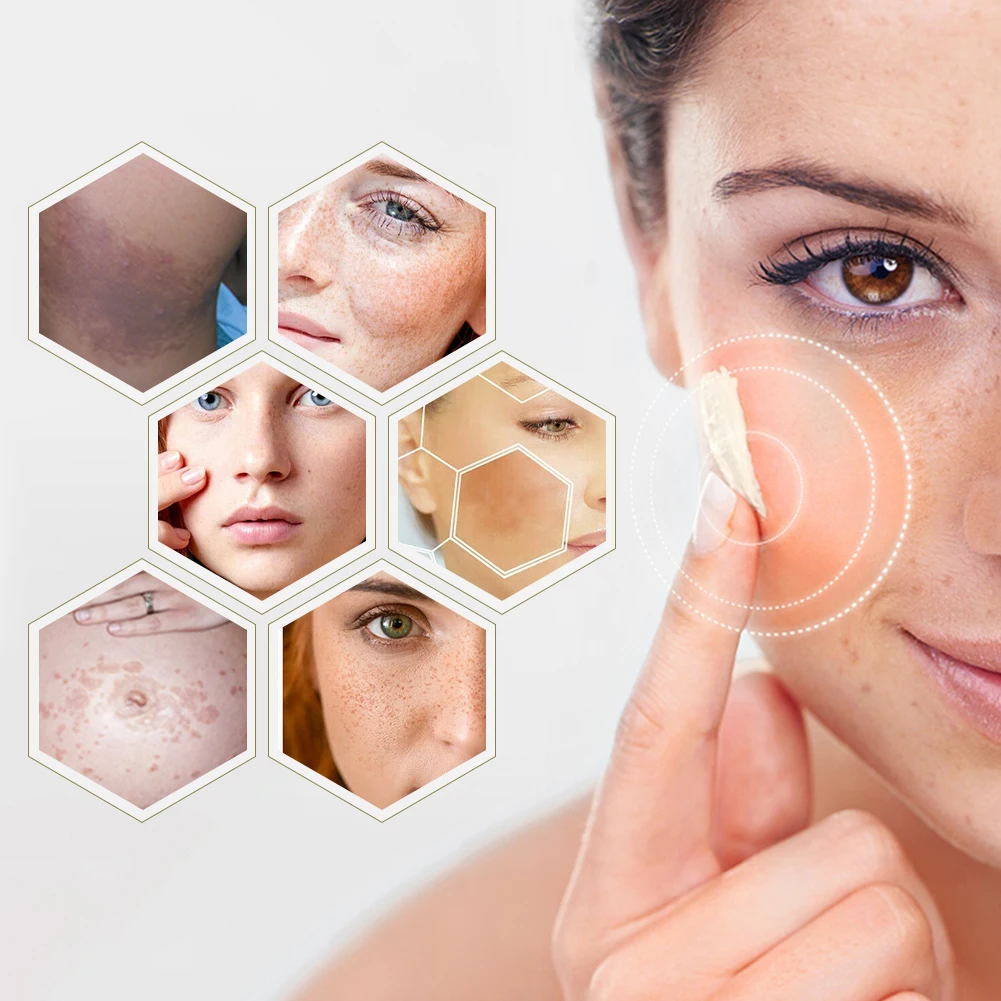 beauty products acne cream for skin care green tea 2 in 1 skin stretch best face cream