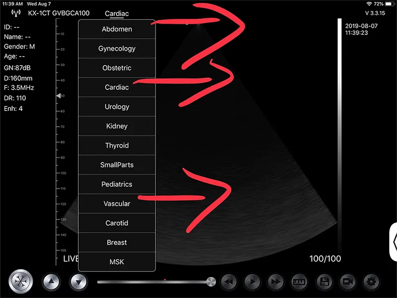 Konted Gen5 ладони ультразвуковой портативный беспроводной ультразвуковая машина 3 в 1 Многофункциональный одиночный датчик для всего тела