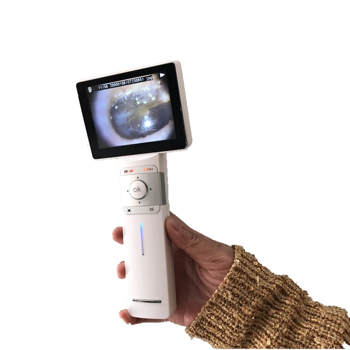 Ophthalmic Equipment Digital Otoscope Ophthalmoscope Dermatoscope Veterinary Video Otoscope