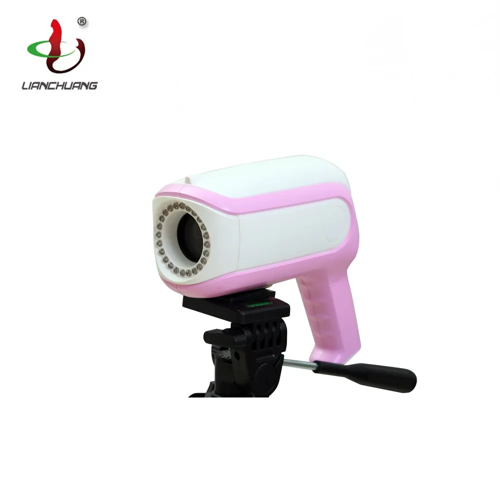 Digital Video Portable Vagina Colposcope camera Sony CCD