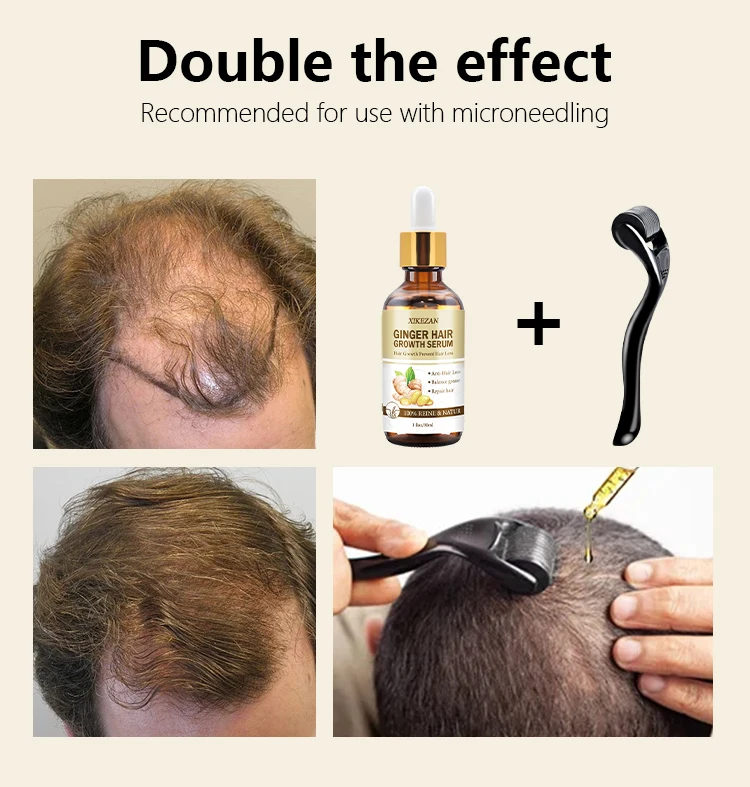 Hair Treatment Anti Loss Serum Ginger Growth Oil Ingrown Organic Hair Fall Serum For Rough And Damage Hair