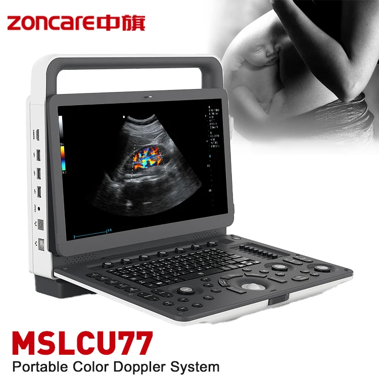 Zoncare M5 3D 4D 5D ультразвуковая машина портативная цена в Пакистане