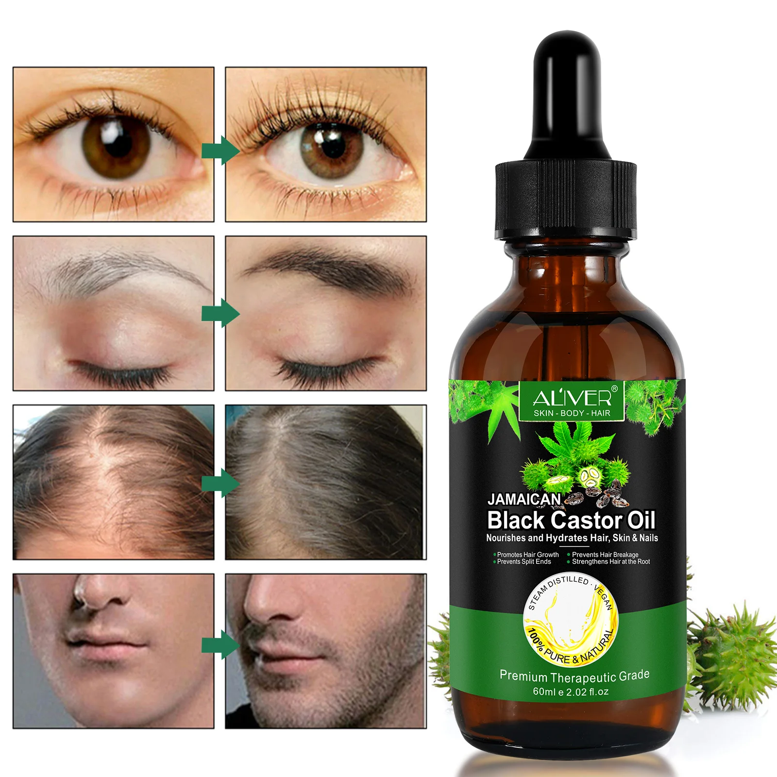 Jamaican Black Castor Oil Hair Growth Stimulate for Nourishes Scalp