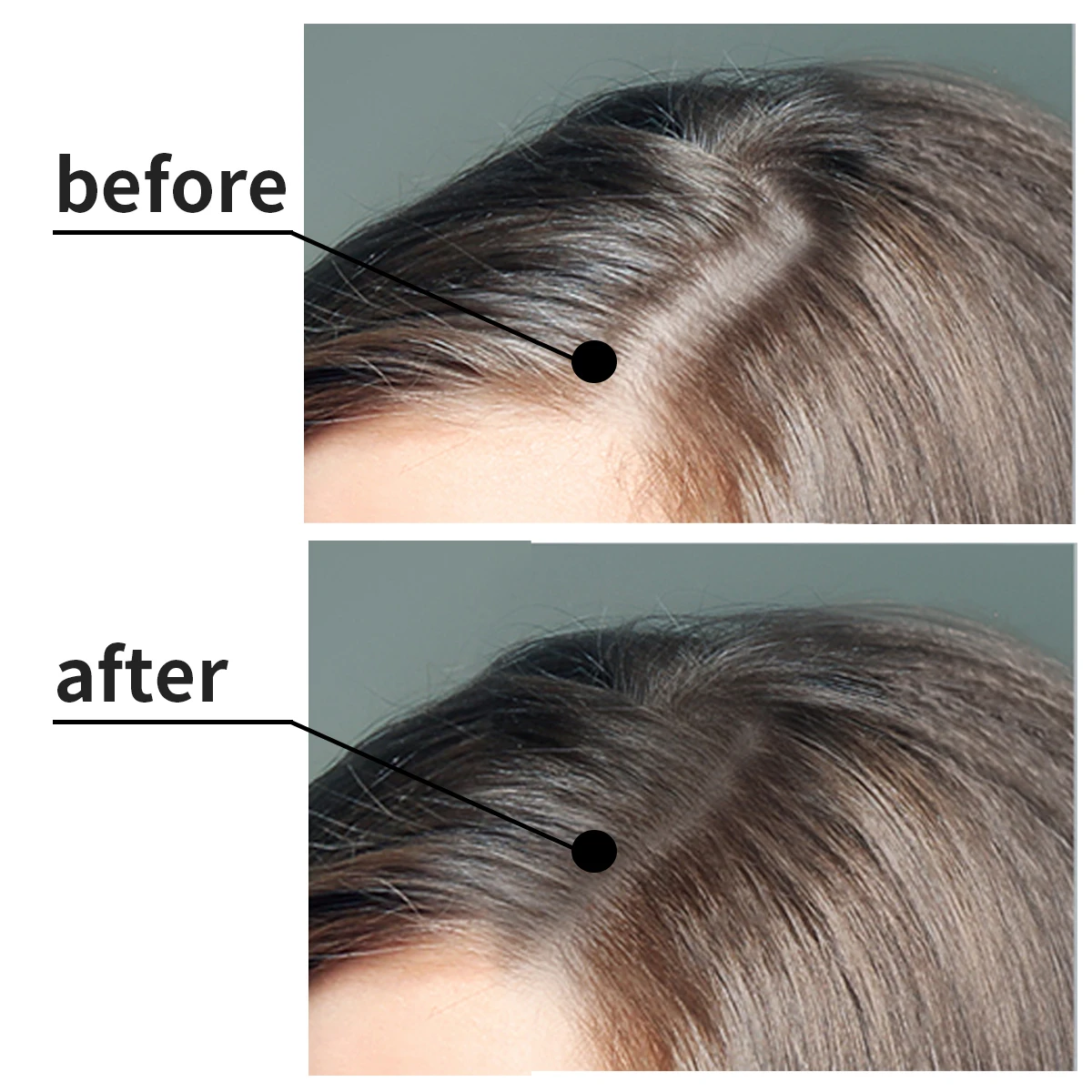 OCCA Private Label 100% Natural Formula Wholesale Nourishing Scalp Elixirs Hair Care Loss Treatment Hair Growth Oil Serum