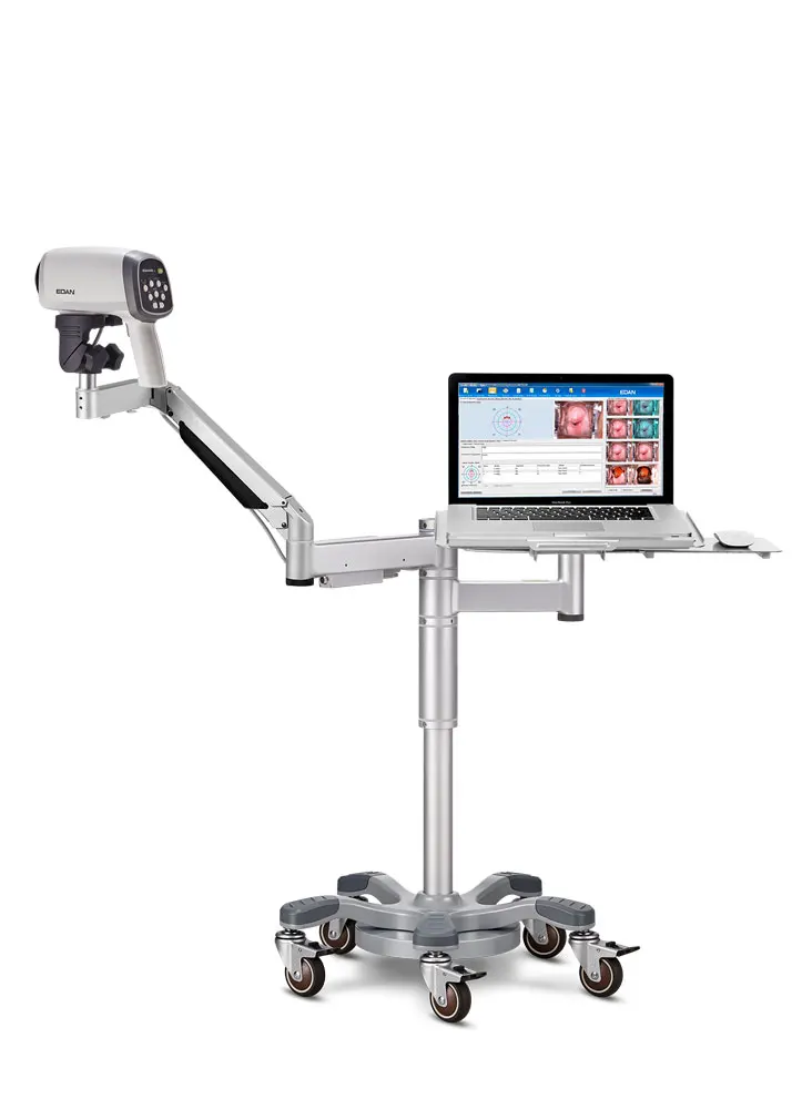 Оригинальное HD видео Colposcope EDAN C3A C6A цифровое colposcopio edan colposcope