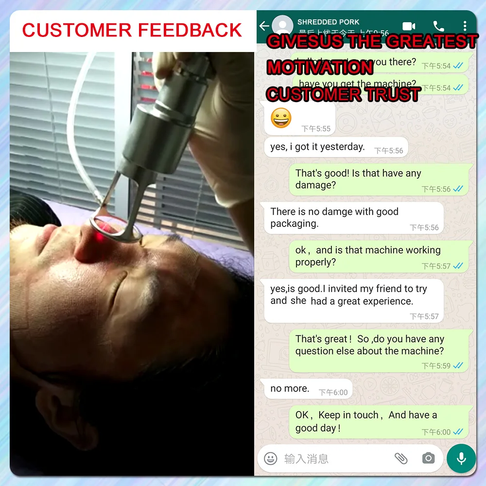 60w co2 fractional laser 4D skin scar/stretch marks removal skin resurfacing vaginal tightening beauty machine with ce