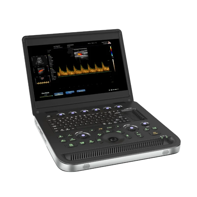 Hot Sales Best Laptop Color Doppler Ultrasound Diagnosis Ultrasound for Hospital Clinic