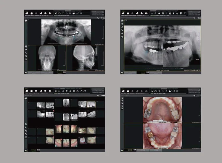 
MY-D068A Hospital radiology equipment x-ray medical digital panoramic dental x ray machine 