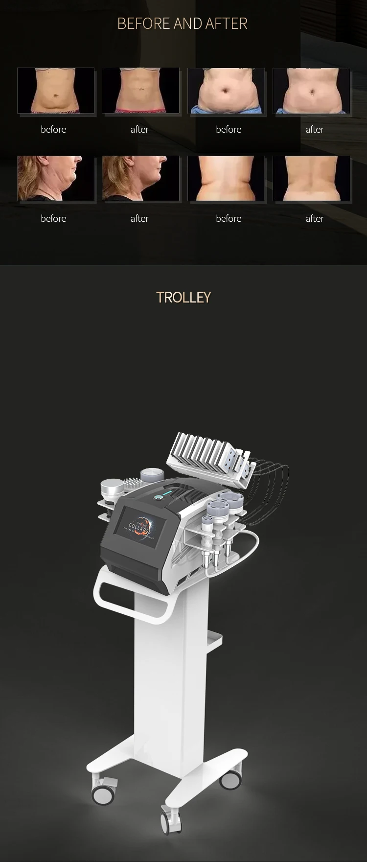 RF Tool 80K Cavitation Ultrasonic Body Slimming Machine Multi-Polar Radio Frequency Anti-Wrinkle Rejuvenation Skin Lift Tighten