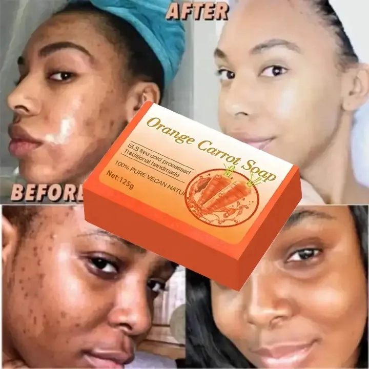 Мыло с морковным цветом лица, Отбеливающее средство от прыщей, для лица и тела, нежное осветление, банное мыло ручной работы