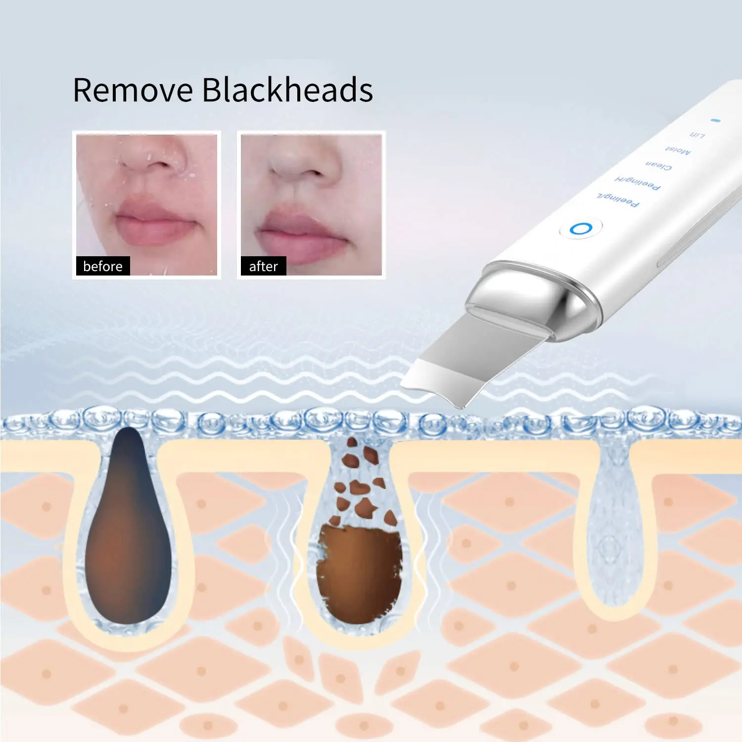COSBEAUTY портативный Ионный ультразвуковой пилинг для лица, ультразвуковой шпатель для кожи, профессиональный скребок для кожи