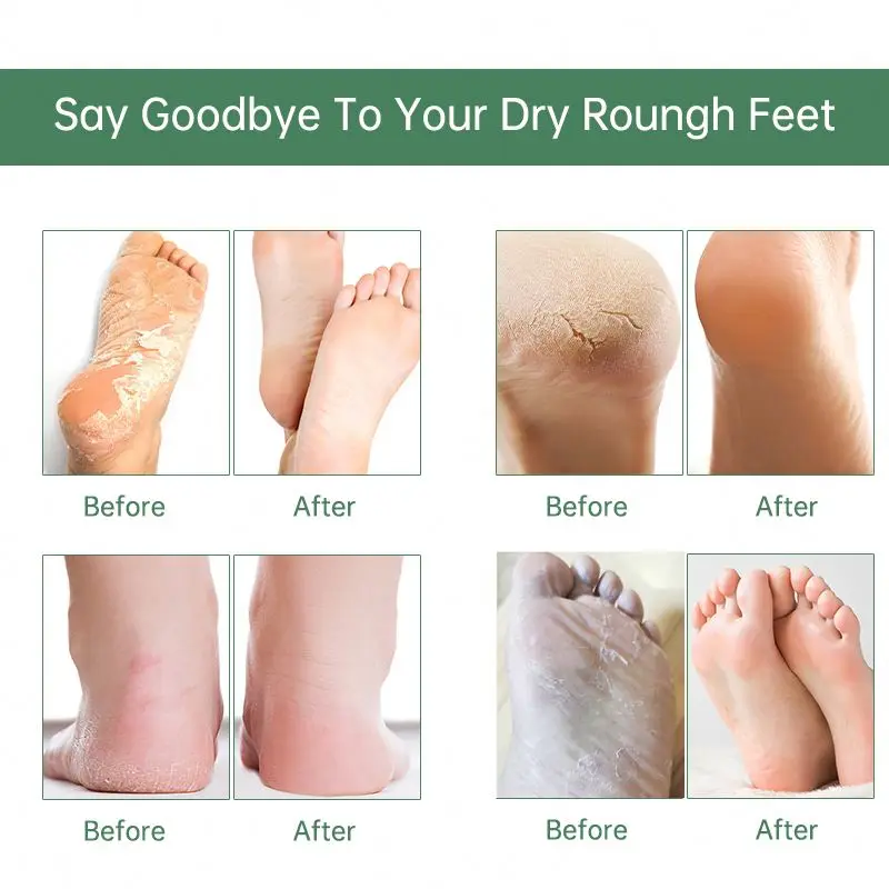 Private Label Feet Skin Care  Feet Peel Mask Foot Exfoliator Mask
