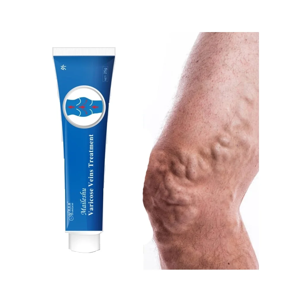 
20g For Varicose Veins Treatment Maileshu Best Cream mai le ping shu Chinese Herbal medicine Ointment Cream 