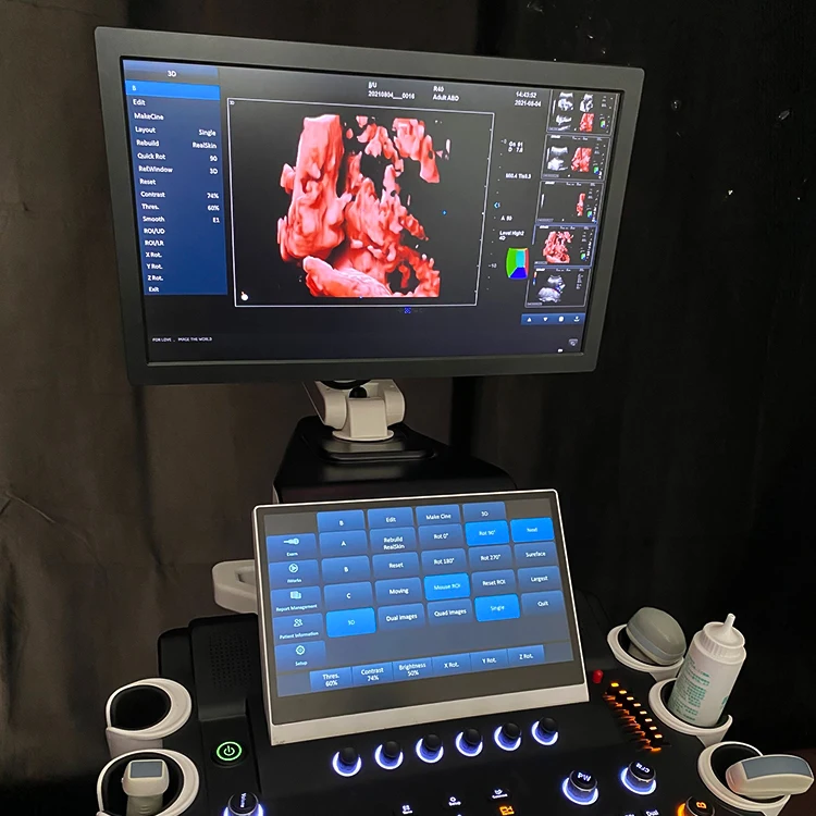 High quality color doppler 3D 4D 5D ultrasound trolley ultrasound gynecology hospital machine ultrasound scanners
