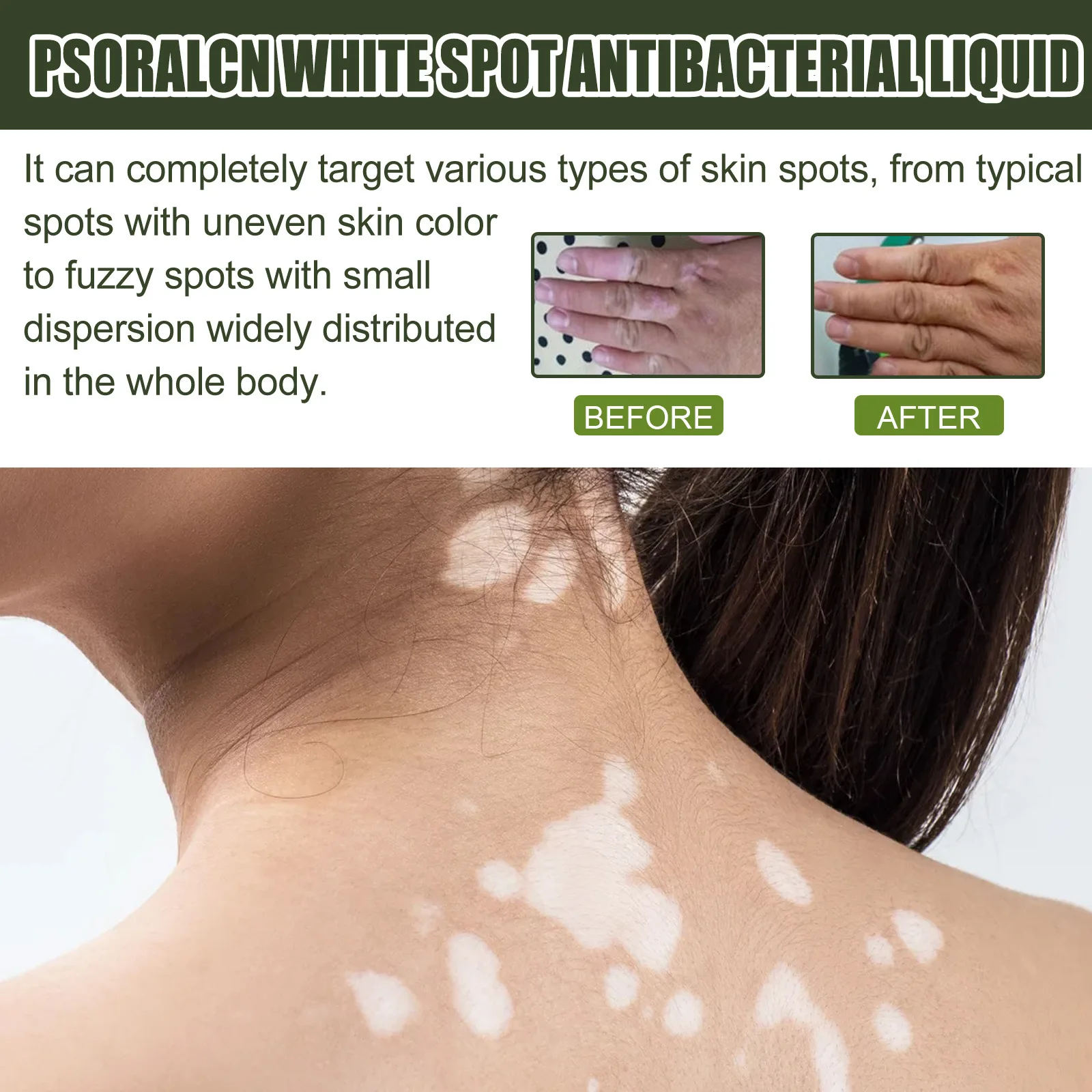 Popular plant extract EELHOE white spot removal anti bacterial liquid repair flecks sweat spots skin moisturizer care serum