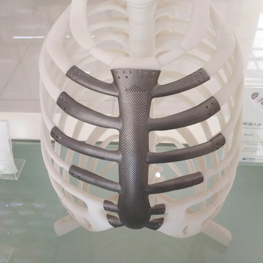 SLM/DMLS Metal 3D Printing For Custom Industrial Equipment Stainless Steel Titanium Robust Quality