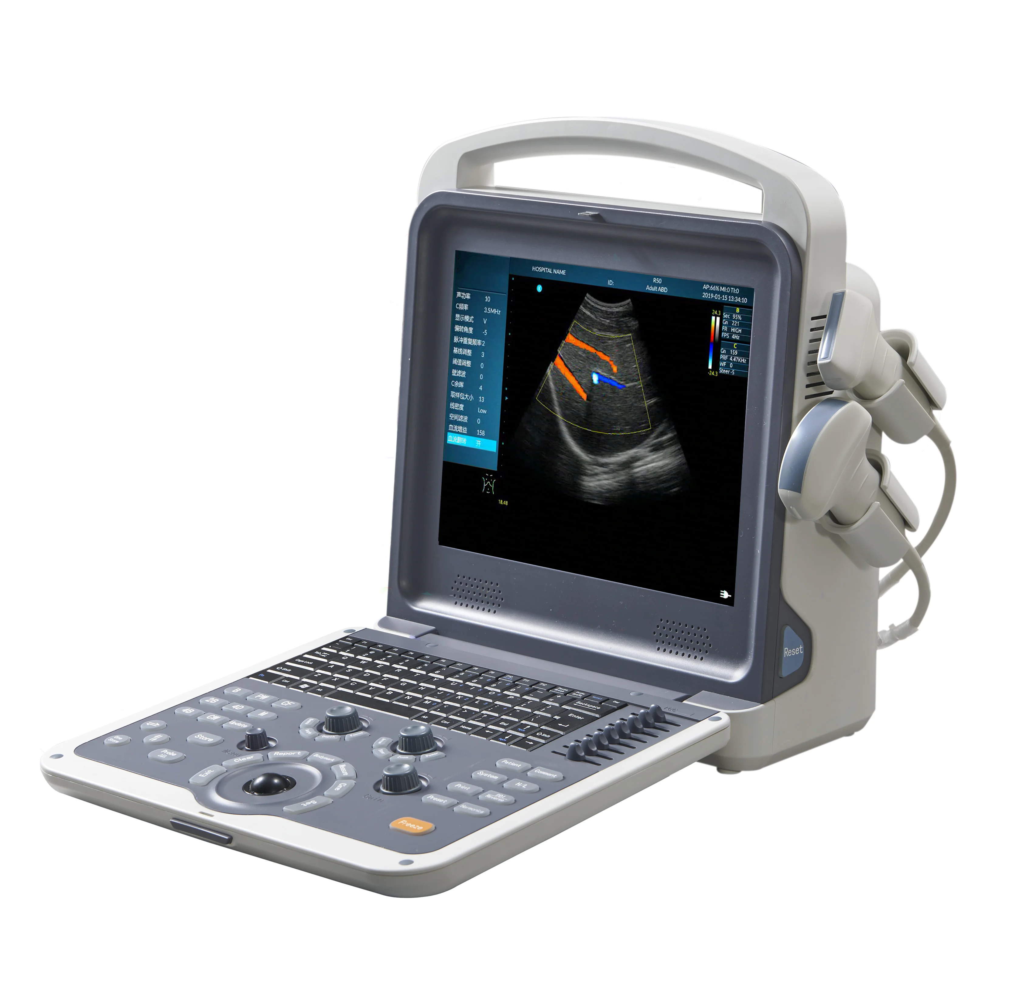 Portable Full Digital Laptop Color Doppler Ultrasonic Diagnostic System Ultrasound Scanner MSLCU62