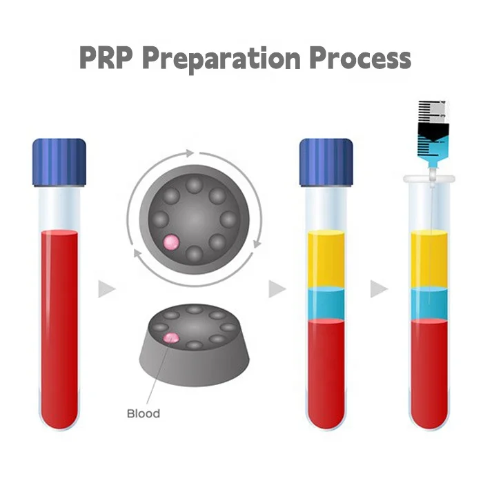 Longtime blood centrifuge machine to separate plasma prp centrifuge machine for prp