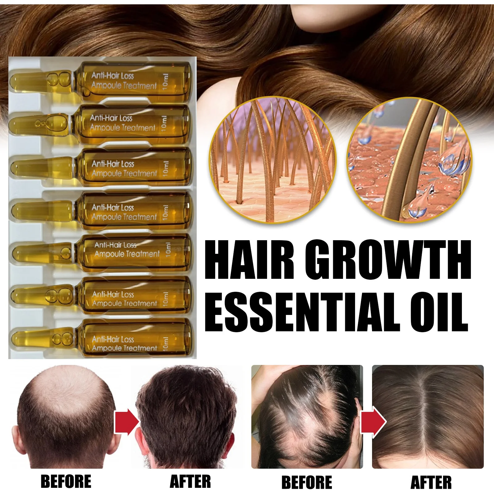 Wholesale Own Brand Anti-hair Loss Ampoule Essence Hair Regeneration