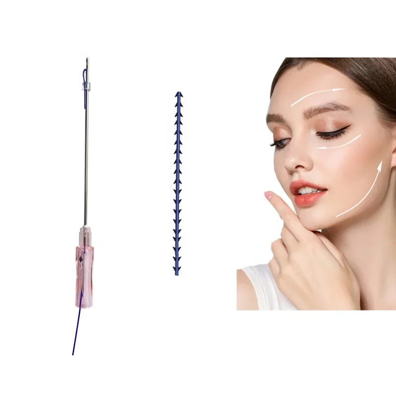 Absorbable Sterile 18g 19g 100mm 120mm Face Lift Thread Chest Buttock Lift Molding Cog Flat Shark Teeth Pdo Threads