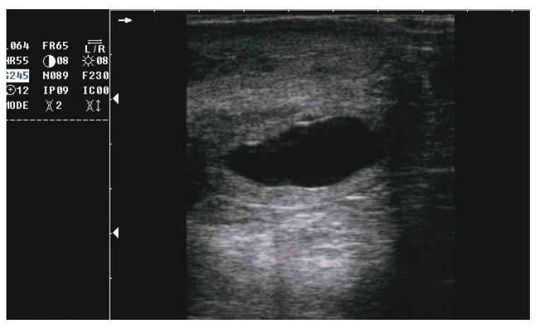 THR-V51A Low Price Handheld Veterinary Ultrasound Machine Animal Ultrasonic Diagnosis System
