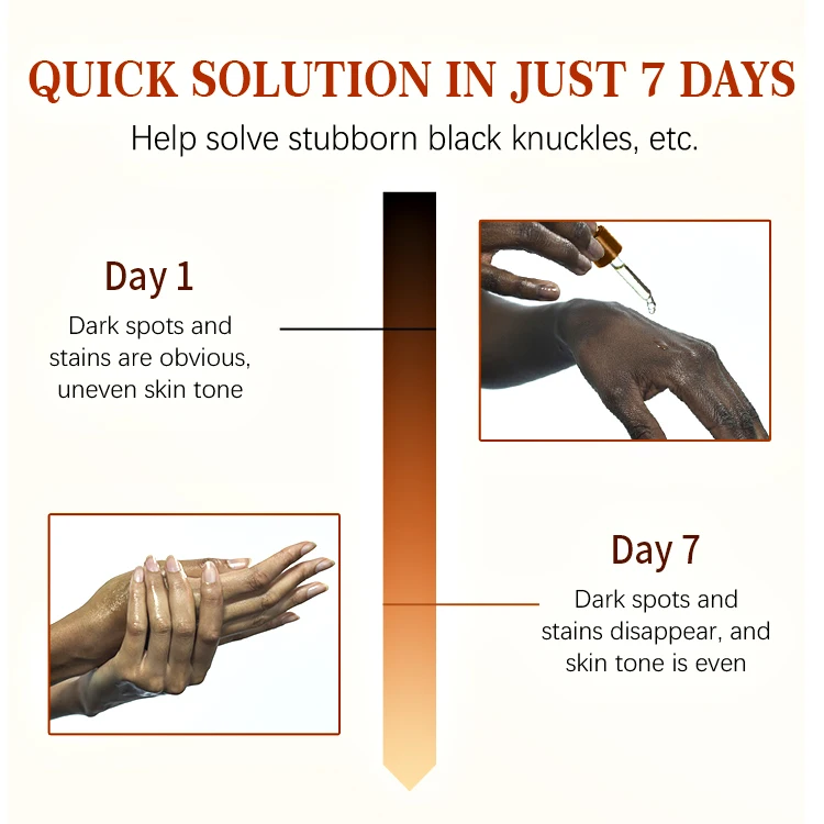 Dark Knuckles Strong Effective Whitening Serum Hand Knuckle Glow Serum for Removing Dark Knuckle Elbow and Knee