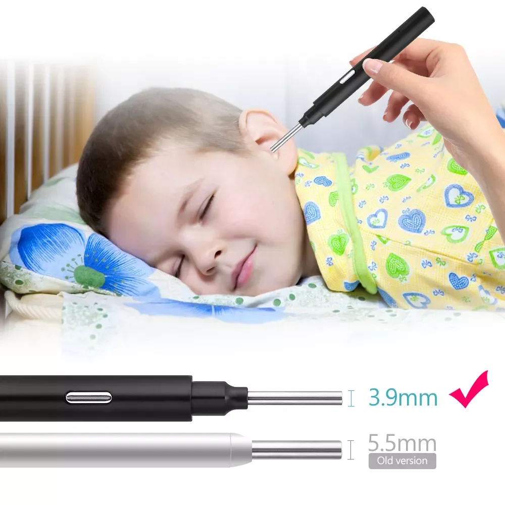 visible ear scoop (3)