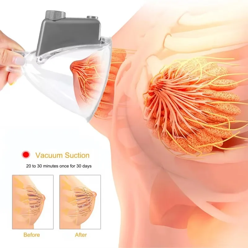 cheap price vacuum therapy cupping buttocks breast enlargement pump