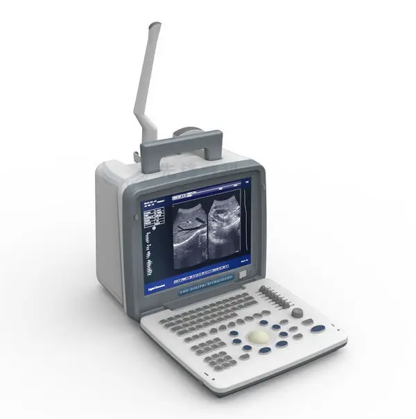 cheap medical B&w b ultrasound machine price with 3mhz probe