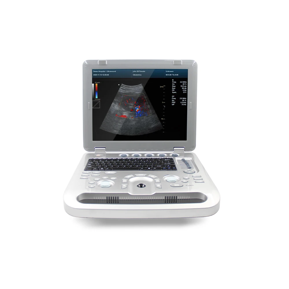 CMS1700A Laptop Digital 3D 4D Ultrasound Machine Cheapest Price Animal Ultrasonic Instrument