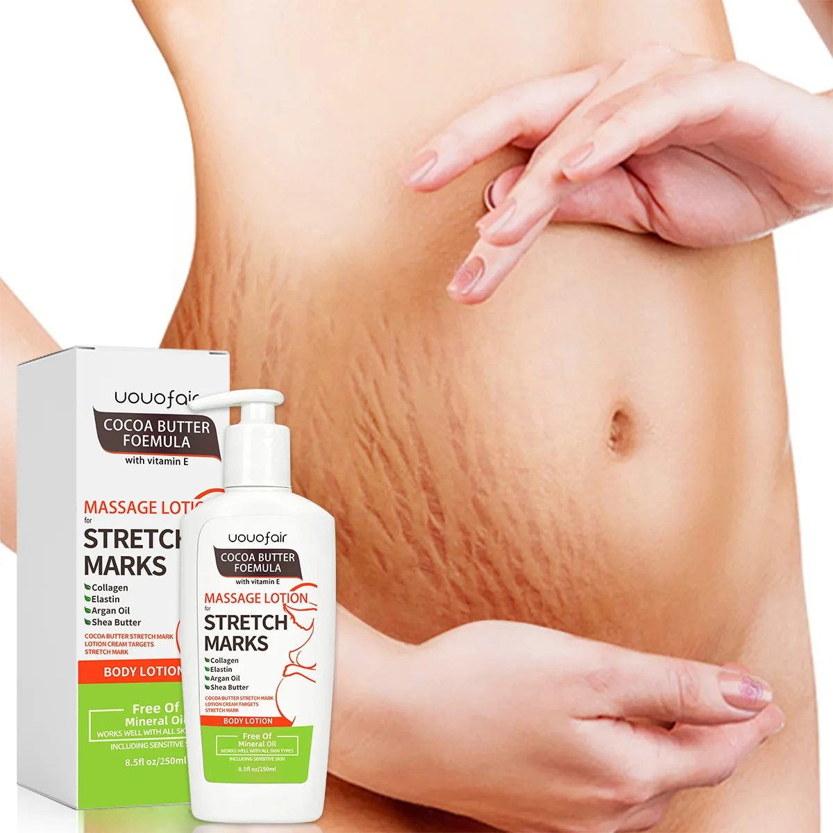 Natural Organic Remove Fat Scar Anti Stretch Mark Lotion Cream Private Label Pregnancy Stretch Marks Removal Cream