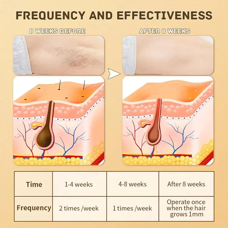 2023 Beperfect Home Use Beauty Intense Pulsed Light Portable IPL Hair Removal Device Professional Laser IPL Hair Removal