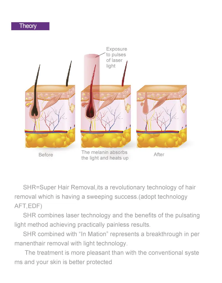 Ipl Hair Removal Intense Pulsed Light Remover Hair Ipl Laser Depilador Ipl Electrolysis Hair Removal Machine opt dpl laser