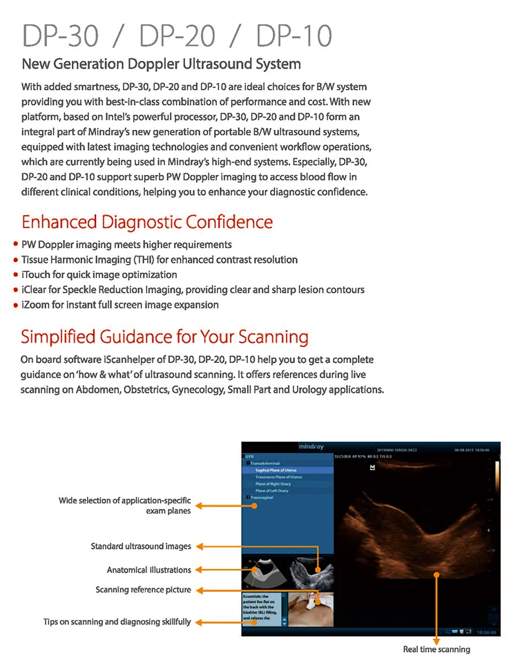 Mindray DP-30 4d ultrasound portable laptop doppler ultrasound scanner