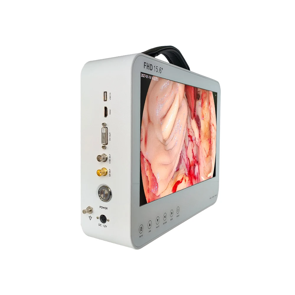 Camjoy медицинская USB эндоскопическая камера для портативной HDMI HD 1080P оптический адаптер медицинский Full эндоскоп