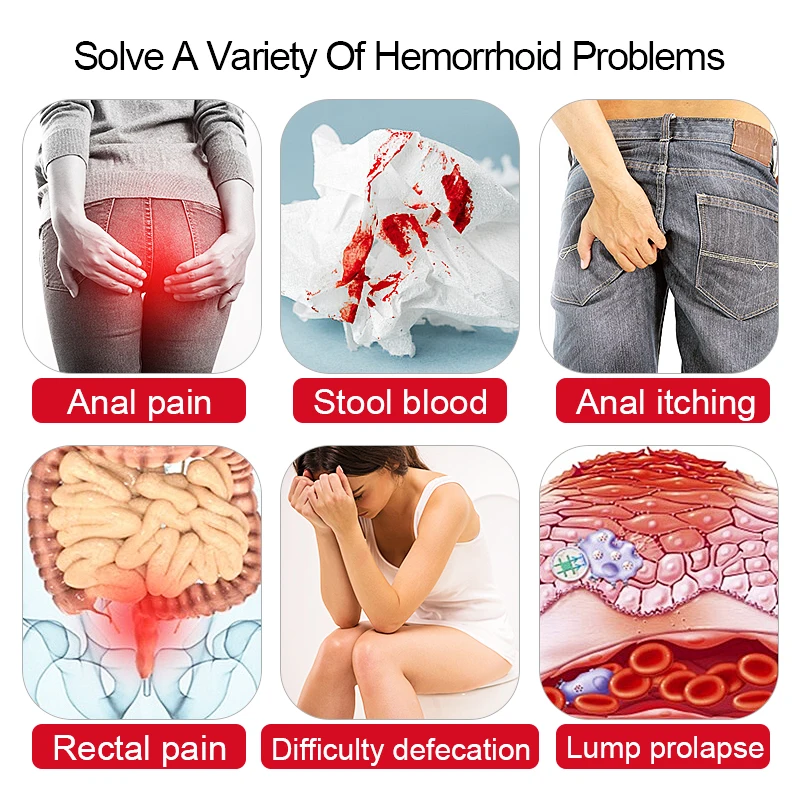Musk Extraction Hemorrhoids Ointment Powerful Hemorrhoids Internal Hemorrhoids Piles External Anal 18g