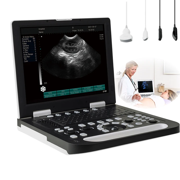 Mindray DP-20 DP-30 DP-50 Portable B/W Ultrasound Machine USG Digital Ultrasonic Imaging System for Human