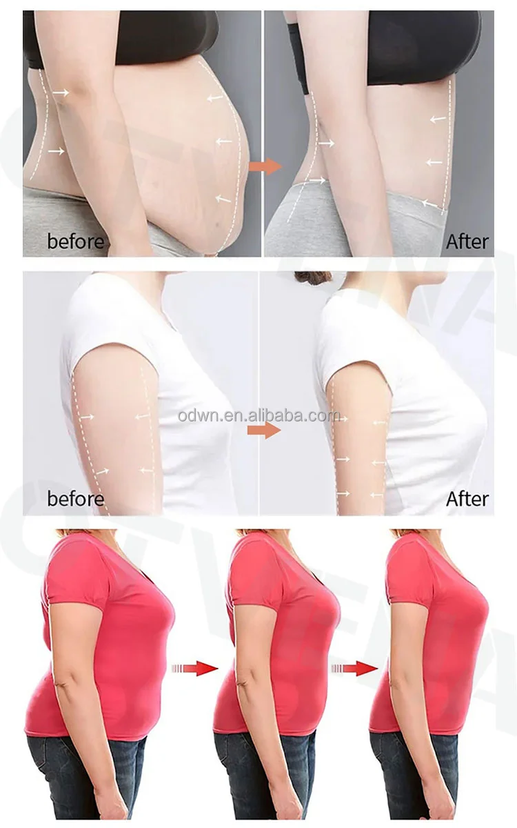 Private Label Waist Body Best Slimming Flat Tummy Set Products Cream Fat Burner Weight Loss Kit For Women