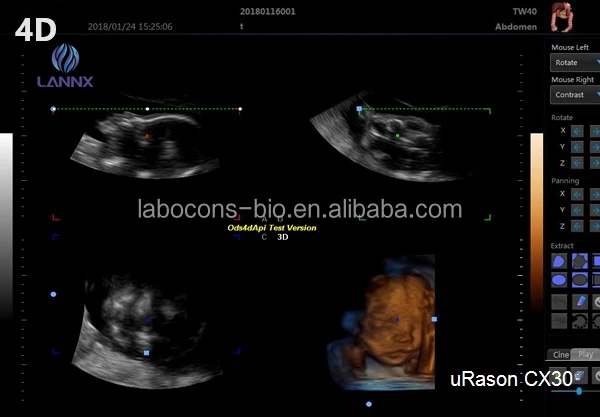 LANNX uRason CX30 New Design Digital Color Doppler Ultrasound Scanner ecografo System 3D/4D optional ultrasonido machine