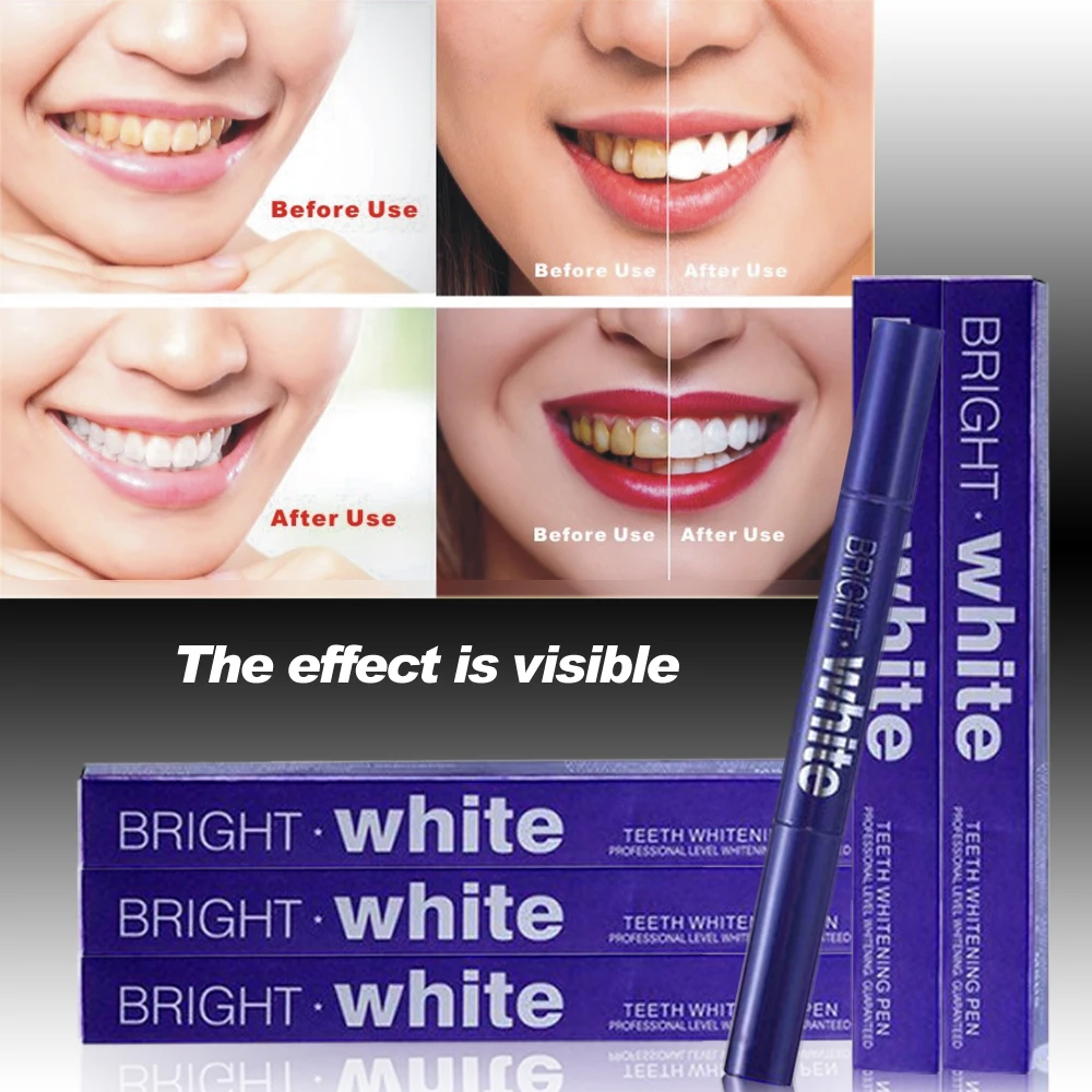 OEM private label logo carbamide peroxide instant dazzling bright whiten bright white teeth whitening pen